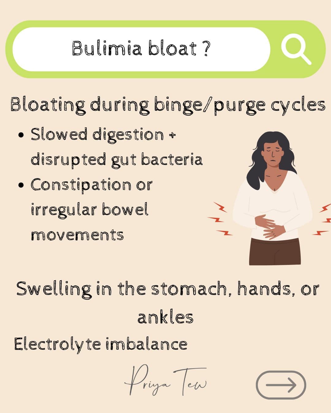 Bulimia bloat: bloating that can happen during the binge/purge cycle
